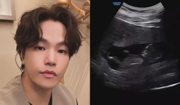 Na YoonKwon Announces Warm Winter! Becoming a Father in December