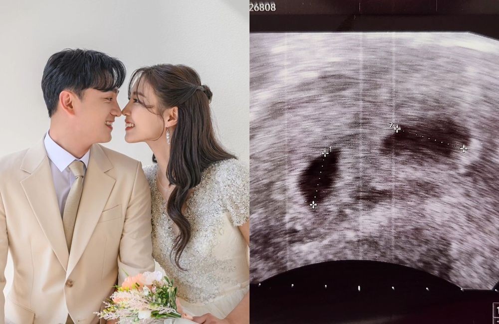 정인영·<b>윤석현</b> 부부, 경사 났다...쌍둥이 부모된다