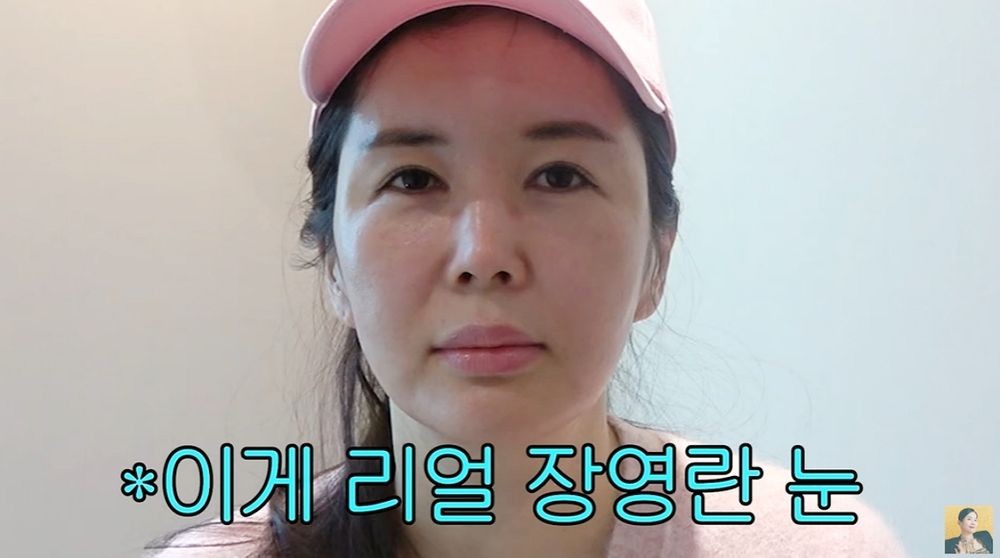 <b>장영란</b>, 6번째 눈 <b>성형</b> '성공적'...남편도 깜짝 놀랐다