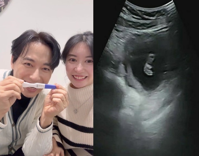 <b>이지훈</b>·아야네, <b>유산</b> 아픔 딛고 임신 5개월…"두 번의 기적"